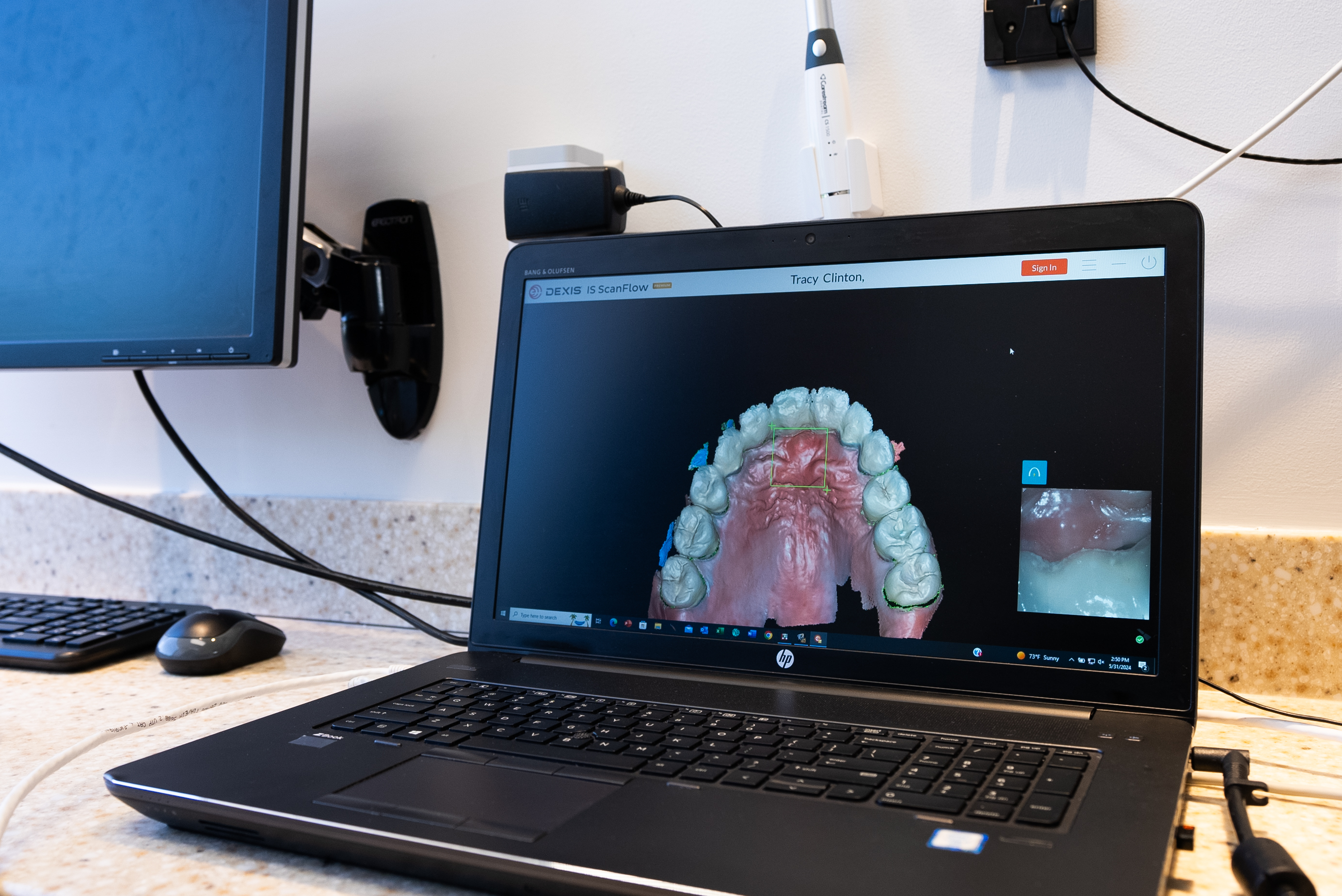 Advanced implant technology and digital planning tools used in Bethesda implant dentistry