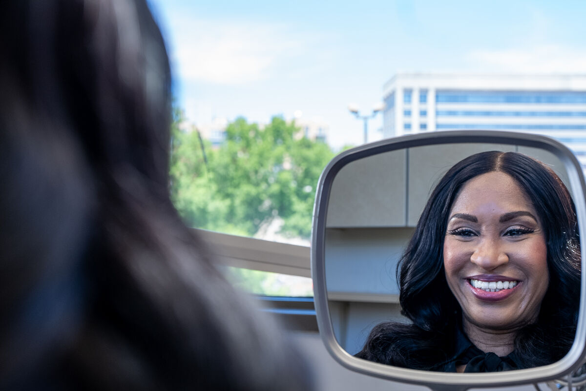 Patient before and after full arch dental implants