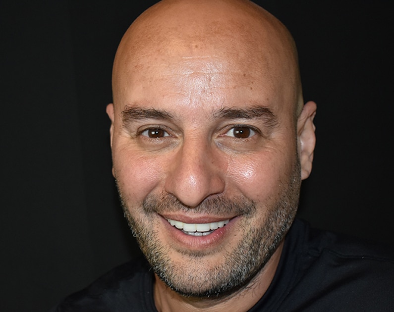 Beautiful smile restored with dental implants by Dr. Marlin at Elite Prosthetic Dentistry near Bethesda